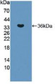 Western Blot; Sample: Recombinant ERN1, Human. Western Blot; Sample: Recombinant ERN1, Human.