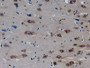 DAB staining on IHC-P; Samples: Porcine Cerebrum Tissue; Primary Ab: 10µg/ml Rabbit Anti-Human ERN1 Antibody Second Ab: 2µg/mL HRP-Linked Caprine Anti-Rabbit IgG Polyclonal Antibody DAB staining on IHC-P; Samples: Porcine Cerebrum Tissue; Primary Ab: 10µg/ml Rabbit Anti-Human ERN1 Antibody Second Ab: 2µg/mL HRP-Linked Caprine Anti-Rabbit IgG Polyclonal Antibody