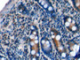 DABstainingonIHC-P.Samples:HumanTissue) DABstainingonIHC-P.Samples:HumanTissue)