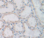 Cubilin (CUBN) Polyclonal Antibody, Cat#CAU24317 Cubilin (CUBN) Polyclonal Antibody, Cat#CAU24317