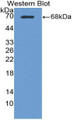 Western Blot; Sample: Recombinant protein.