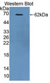 Western Blot; Sample: Recombinant protein. Western Blot; Sample: Recombinant protein.