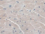 DAB staining on IHC-P; Samples: Mouse Heart Tissue; Primary Ab: 10µg/ml Rabbit Anti-Mouse AGA Antibody Second Ab: 2µg/mL HRP-Linked Caprine Anti-Rabbit IgG Polyclonal Antibody DAB staining on IHC-P; Samples: Mouse Heart Tissue; Primary Ab: 10µg/ml Rabbit Anti-Mouse AGA Antibody Second Ab: 2µg/mL HRP-Linked Caprine Anti-Rabbit IgG Polyclonal Antibody