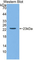 Western Blot; Sample: Recombinant protein. Western Blot; Sample: Recombinant protein.