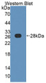 Western Blot; Sample: Recombinant protein.