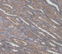 DAB staining on IHC-P; Samples: Human Kidney Tissue DAB staining on IHC-P; Samples: Human Kidney Tissue
