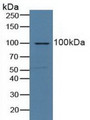 Western Blot; Sample: Human Lung Tissue. Western Blot; Sample: Human Lung Tissue.