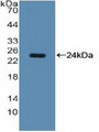 Western Blot; Sample: Recombinant NCL, Human. Western Blot; Sample: Recombinant NCL, Human.