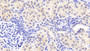 DAB staining on IHC-P; Samples: Human Kidney Tissue;  Primary Ab: 20μg/ml Rabbit Anti-Human ZYX Antibody Second Ab: 2µg/mL HRP-Linked Caprine Anti-Rabbit IgG Polyclonal Antibody 