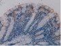 Figure. DAB staining on IHC-P; Samples: Mouse Intestine Tissue. Figure. DAB staining on IHC-P; Samples: Mouse Intestine Tissue.