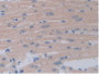 DAB staining on IHC-P; Samples: Mouse Heart Tissue. DAB staining on IHC-P; Samples: Mouse Heart Tissue.