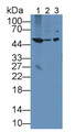 Western Blot; Sample: Lane1: Rat Spleen lysate; Lane2: Rat Skeletal muscle lysate; Lane3: Human K562 cell lysate; Primary Ab: 3µg/mL Rabbit Anti-Human BLMH Antibody; Second Ab: 0.2µg/mL HRP-Linked Caprine Anti-Rabbit IgG Polyclonal Antibody; Western Blot; Sample: Lane1: Rat Spleen lysate; Lane2: Rat Skeletal muscle lysate; Lane3: Human K562 cell lysate; Primary Ab: 3µg/mL Rabbit Anti-Human BLMH Antibody; Second Ab: 0.2µg/mL HRP-Linked Caprine Anti-Rabbit IgG Polyclonal Antibody;