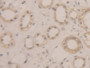 DAB staining on IHC-P; Samples: Human Kidney Tissue; Primary Ab: 20µg/ml Rabbit Anti-Human BLMH Antibody Second Ab: 2µg/mL HRP-Linked Caprine Anti-Rabbit IgG Polyclonal Antibody DAB staining on IHC-P; Samples: Human Kidney Tissue; Primary Ab: 20µg/ml Rabbit Anti-Human BLMH Antibody Second Ab: 2µg/mL HRP-Linked Caprine Anti-Rabbit IgG Polyclonal Antibody