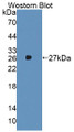Western Blot; Sample: Recombinant protein. Western Blot; Sample: Recombinant protein.