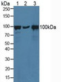 Western Blot; Sample: Lane1: Human Hela Cells; Lane2: Porcine Brain Tissue; Lane3: Human A431 Cells.