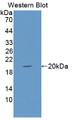 Western Blot; Sample: Recombinant protein. Western Blot; Sample: Recombinant protein.