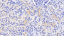 DAB staining on fromalin fixed paraffin- embedded Kidney tissue)