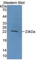 Western Blot; Sample: Recombinant protein.