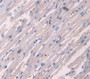 Collagen Type XVIII (COL18) Polyclonal Antibody, Cat#CAU24624 Collagen Type XVIII (COL18) Polyclonal Antibody, Cat#CAU24624