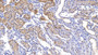 DAB staining on IHC-P; Samples: Mouse Kidney Tissue; Primary Ab: 10µg/ml Rabbit Anti-Mouse COL18 Antibody Second Ab: 2µg/mL HRP-Linked Caprine Anti-Rabbit IgG Polyclonal Antibody DAB staining on IHC-P; Samples: Mouse Kidney Tissue; Primary Ab: 10µg/ml Rabbit Anti-Mouse COL18 Antibody Second Ab: 2µg/mL HRP-Linked Caprine Anti-Rabbit IgG Polyclonal Antibody