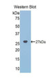 Western Blot; Sample: Recombinant protein. Western Blot; Sample: Recombinant protein.