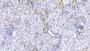 DAB staining on IHC-P; Samples: Human Kidney Tissue; Primary Ab: 20μg/ml Rabbit Anti-Human NOG Antibody Second Ab: 2µg/mL HRP-Linked Caprine Anti-Rabbit IgG Polyclonal Antibody DAB staining on IHC-P; Samples: Human Kidney Tissue; Primary Ab: 20μg/ml Rabbit Anti-Human NOG Antibody Second Ab: 2µg/mL HRP-Linked Caprine Anti-Rabbit IgG Polyclonal Antibody