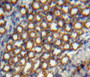 DAB staining on fromalin fixed paraffin-embedded kidney tissue) DAB staining on fromalin fixed paraffin-embedded kidney tissue)