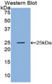 Western Blot; Sample: Recombinant protein. Western Blot; Sample: Recombinant protein.