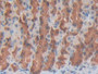 DAB staining on fromalin fixed paraffin- embedded spleen tissue)