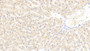 DAB staining on IHC-P; Samples: Human Liver Tissue;  Primary Ab: 20μg/ml Rabbit Anti-Human LAMC3 Antibody Second Ab: 2µg/mL HRP-Linked Caprine Anti-Rabbit IgG Polyclonal Antibody 