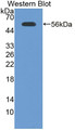Western Blot; Sample: Recombinant protein.