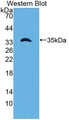 Western Blot; Sample: Recombinant protein. Western Blot; Sample: Recombinant protein.