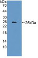 Western Blot; Sample: Recombinant LAMb3, Mouse. Western Blot; Sample: Recombinant LAMb3, Mouse.