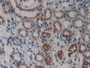 DAB staining on IHC-P; Samples: Mouse Kidney Tissue; Primary Ab: 10µg/ml Rabbit Anti-Mouse LAMb3 Antibody Second Ab: 2µg/mL HRP-Linked Caprine Anti-Rabbit IgG Polyclonal Antibody DAB staining on IHC-P; Samples: Mouse Kidney Tissue; Primary Ab: 10µg/ml Rabbit Anti-Mouse LAMb3 Antibody Second Ab: 2µg/mL HRP-Linked Caprine Anti-Rabbit IgG Polyclonal Antibody