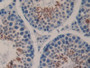 DAB staining on IHC-P; Samples: Mouse Testis Tissue. DAB staining on IHC-P; Samples: Mouse Testis Tissue.