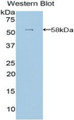 Western Blot; Sample: Recombinant protein. Western Blot; Sample: Recombinant protein.