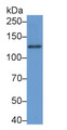 Western Blot; Sample: A431 cell lysate; Primary Ab: 5μg/ml Rabbit Anti-Human LAMb3 Antibody; Second Ab: 0.2µg/mL HRP-Linked Caprine Anti-Rabbit IgG Polyclonal Antibody; Western Blot; Sample: A431 cell lysate; Primary Ab: 5μg/ml Rabbit Anti-Human LAMb3 Antibody; Second Ab: 0.2µg/mL HRP-Linked Caprine Anti-Rabbit IgG Polyclonal Antibody;