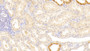 DAB staining on IHC-P; Samples: Human Kidney Tissue;  Primary Ab: 20μg/ml Rabbit Anti-Human LAMb3 Antibody Second Ab: 2µg/mL HRP-Linked Caprine Anti-Rabbit IgG Polyclonal Antibody  DAB staining on IHC-P; Samples: Human Kidney Tissue;  Primary Ab: 20μg/ml Rabbit Anti-Human LAMb3 Antibody Second Ab: 2µg/mL HRP-Linked Caprine Anti-Rabbit IgG Polyclonal Antibody
