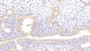 DAB staining on IHC-P; Samples: Rat Uterus Tissue; Primary Ab: 10μg/ml Rabbit Anti-Rat LAMb2 Antibody Second Ab: 2µg/mL HRP-Linked Caprine Anti-Rabbit IgG Polyclonal Antibody DAB staining on IHC-P; Samples: Rat Uterus Tissue; Primary Ab: 10μg/ml Rabbit Anti-Rat LAMb2 Antibody Second Ab: 2µg/mL HRP-Linked Caprine Anti-Rabbit IgG Polyclonal Antibody