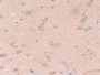 DAB staining on IHC-P; Samples: Rat Spinal cord Tissue; Primary Ab: 10µg/ml Rabbit Anti-Rat LAMb2 Antibody Second Ab: 2µg/mL HRP-Linked Caprine Anti-Rabbit IgG Polyclonal Antibody DAB staining on IHC-P; Samples: Rat Spinal cord Tissue; Primary Ab: 10µg/ml Rabbit Anti-Rat LAMb2 Antibody Second Ab: 2µg/mL HRP-Linked Caprine Anti-Rabbit IgG Polyclonal Antibody