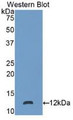 Western Blot; Sample: Recombinant protein. Western Blot; Sample: Recombinant protein.