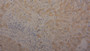 DAB staining on IHC-P. Samples: Human Tissue)
