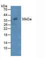 Western Blot; Sample: Human Serum. Western Blot; Sample: Human Serum.