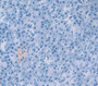 Growth Differentiation Factor 15 (GDF15) Polyclonal Antibody, Cat#CAU24812 Growth Differentiation Factor 15 (GDF15) Polyclonal Antibody, Cat#CAU24812