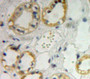 DAB staining on fromalin fixed paraffin-embedded kidney tissue)