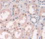 Used in DAB staining on fromalin fixed paraffin- embedded Kidney tissue Used in DAB staining on fromalin fixed paraffin- embedded Kidney tissue