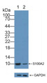 Knockout Varification: ; Lane 1: Wild-type BXPC3 cell lysate; ; Lane 2: S100A2 knockout BXPC3 cell lysate; ; Predicted MW: 11kd ; Observed MW: 10kd; Primary Ab: 3µg/ml Rabbit Anti-Human S100A2 Antibody; Second Ab: 0.2µg/mL HRP-Linked Caprine Anti-Rabbit IgG Polyclonal Antibody; Knockout Varification: ; Lane 1: Wild-type BXPC3 cell lysate; ; Lane 2: S100A2 knockout BXPC3 cell lysate; ; Predicted MW: 11kd ; Observed MW: 10kd; Primary Ab: 3µg/ml Rabbit Anti-Human S100A2 Antibody; Second Ab: 0.2µg/mL HRP-Linked Caprine Anti-Rabbit IgG Polyclonal Antibody;