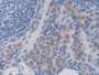 DAB staining on IHC-P; Samples: Mouse Ovary Tissue)