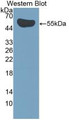 Western Blot; Sample: Recombinant protein. Western Blot; Sample: Recombinant protein.