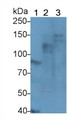 Western Blot; Sample: Lane1: Mouse Serum; Lane2: Mouse Liver lysate; Lane3: Mouse Lung lysate; Primary Ab: 1μg/ml Rabbit Anti-Mouse PKN2 Antibody; Second Ab: 0.2µg/mL HRP-Linked Caprine Anti-Rabbit IgG Polyclonal Antibody;